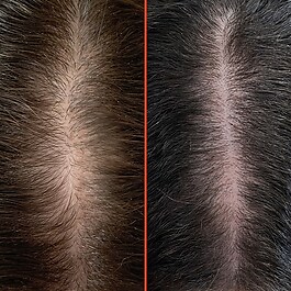 HoliRoots™ Hair Oil - Strengthening Pre-wash Hair Treatment Oil